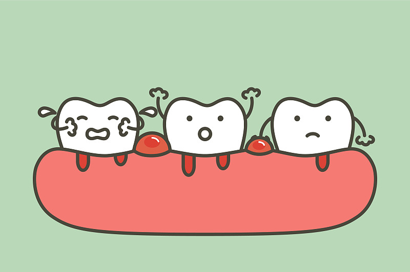 牙周炎或牙齦疾病伴出血圖片素材