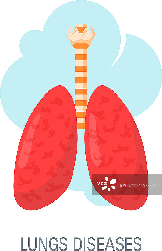 人体肺部疾病概念的扁平风格图片素材