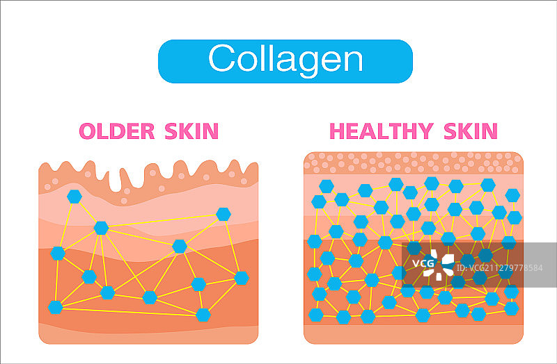 胶原蛋白使皮肤老化和健康图片素材