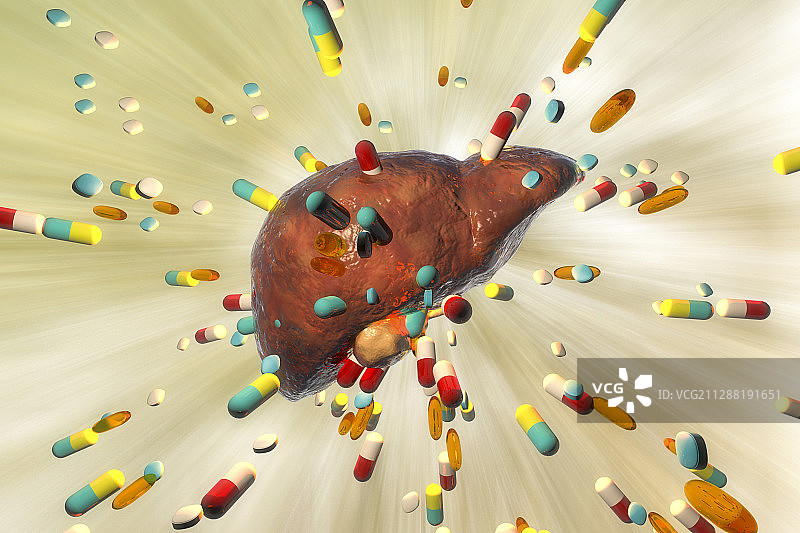 药物引起的肝毒性作用,说明图片素材