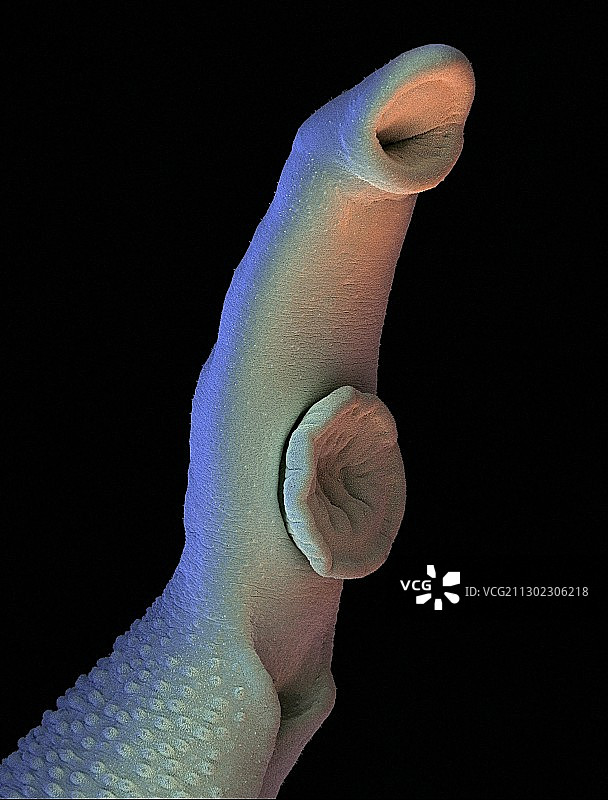 血吸虫侥幸,扫描电镜图片素材