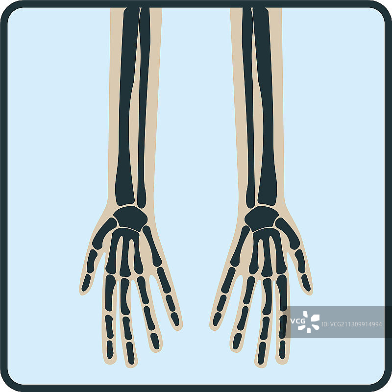 手臂手骨x射线概念图标x射线人图片素材