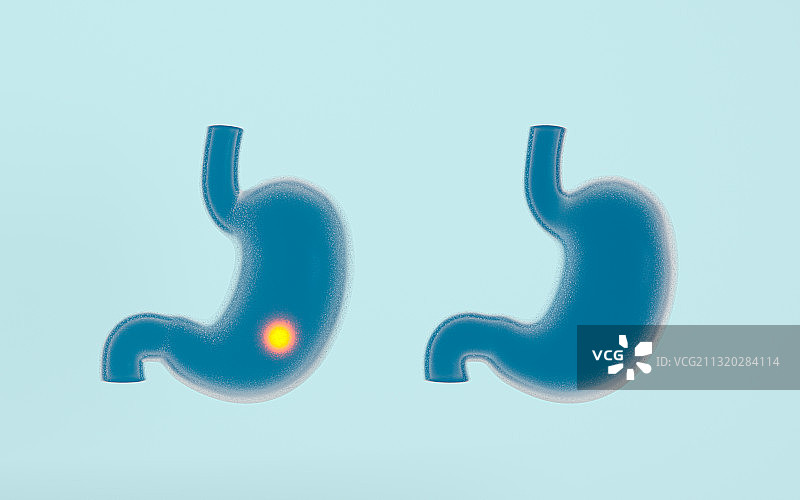 胃部图解 3D渲染图片素材