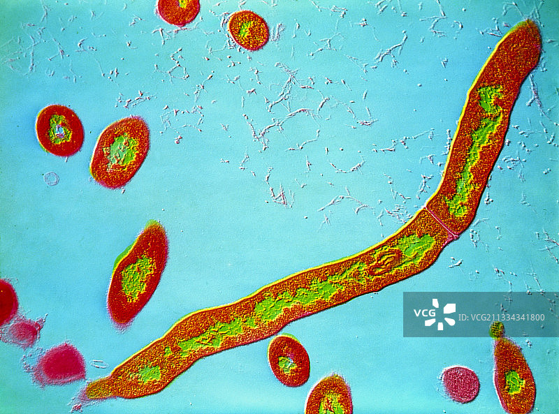 诺卡氏菌着色透射电镜图片素材