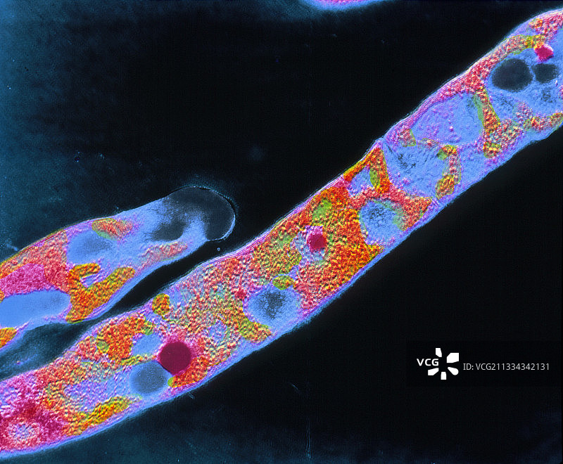 结核分枝杆菌F/col透射电镜图片素材