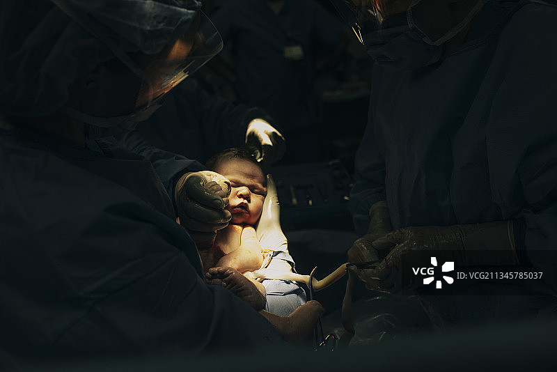 在剖腹产手术中，医生们努力将婴儿从妇女的子宫中取出。图片素材