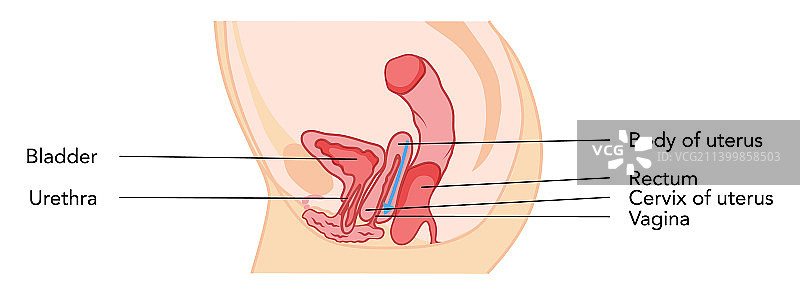 子宫脱垂女性生殖系统子宫图片素材