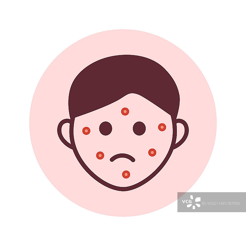 脸上的皮疹标志着人的痛苦图片素材