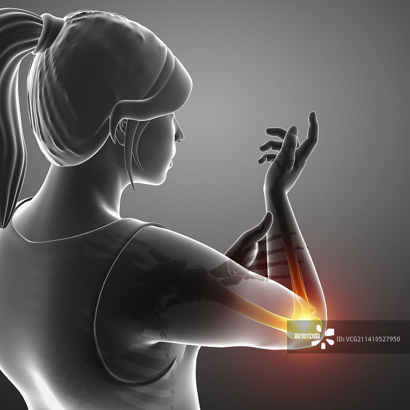 肘部疼痛的妇女，插图图片素材