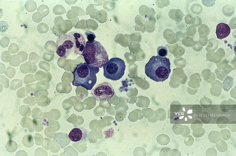 显示白细胞的血液涂片的LM图片素材