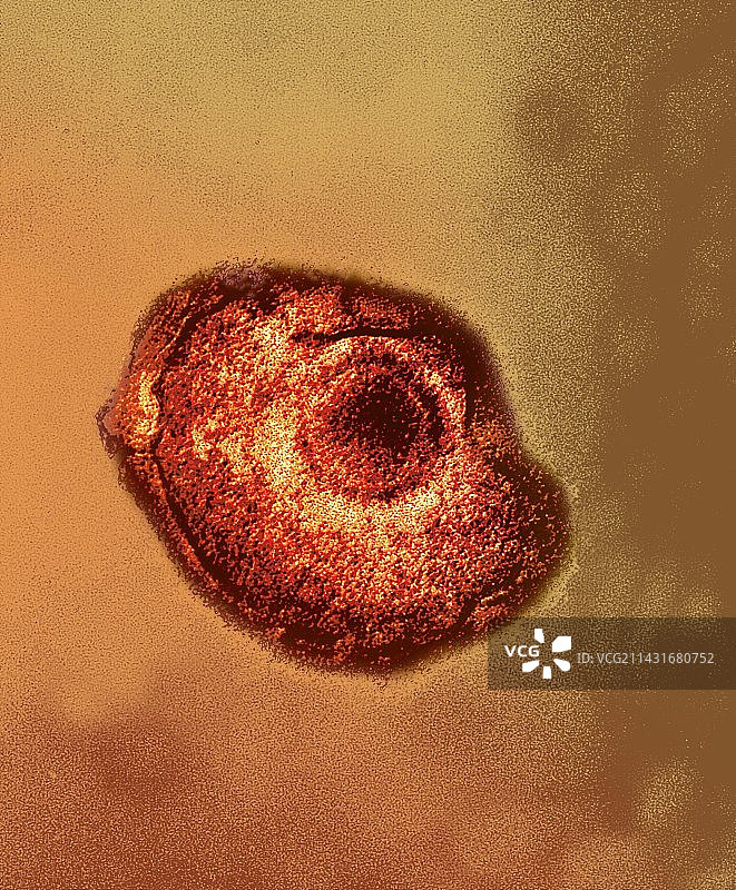 水痘带状疱疹病毒颗粒，透射电镜图片素材