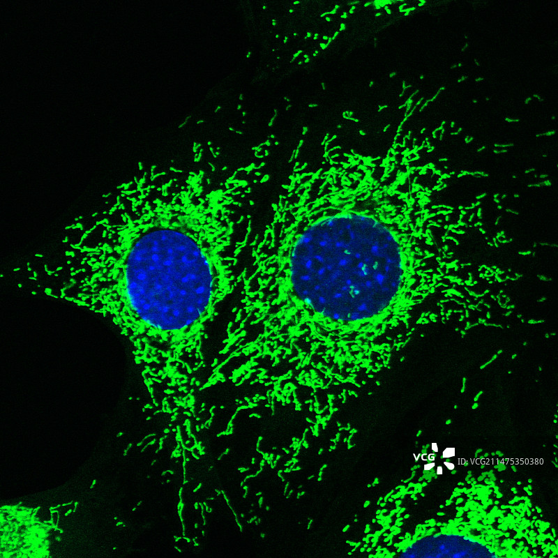 癌症相关成纤维细胞，共聚焦光显微照片图片素材