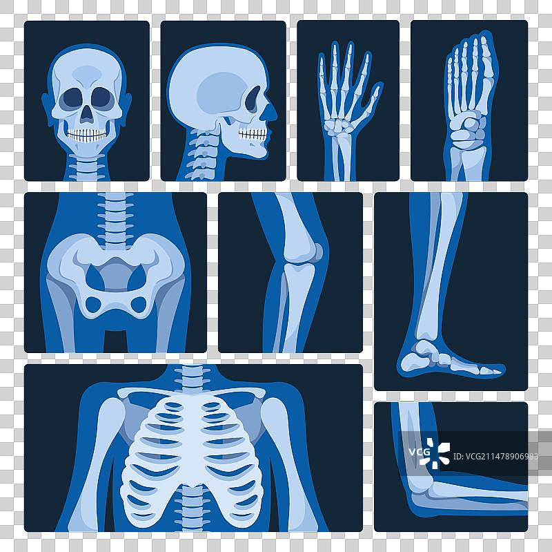 x射线图片集医学影像制作图片素材