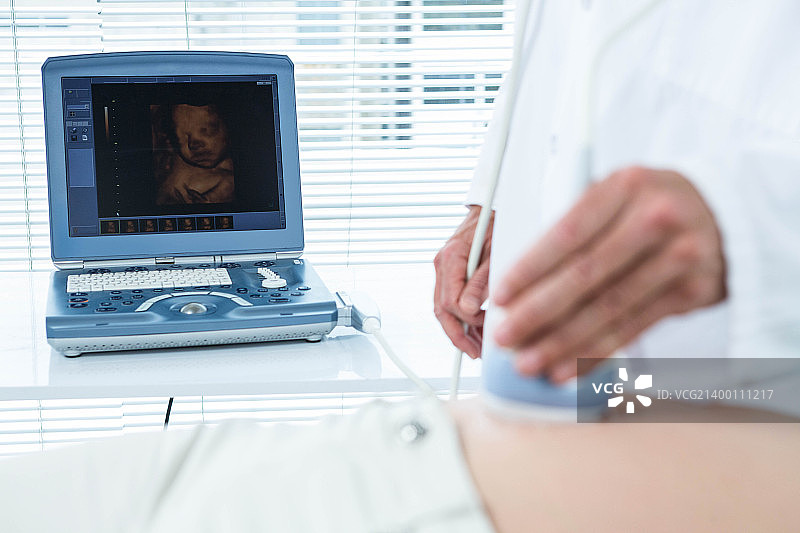 正在接受超声检查的孕妇图片素材