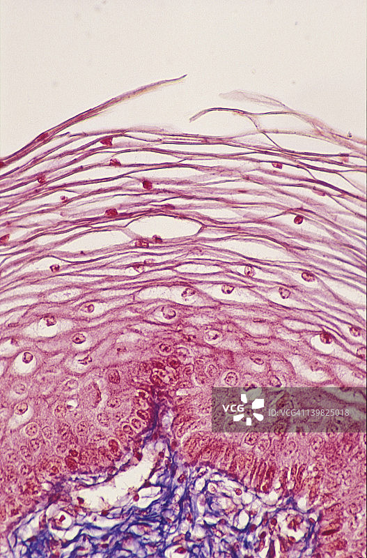 阴道分层鳞状上皮的显微照片显示上皮细胞脱屑;近表面细胞呈扁平状;马洛里的污点,100 x。图片素材