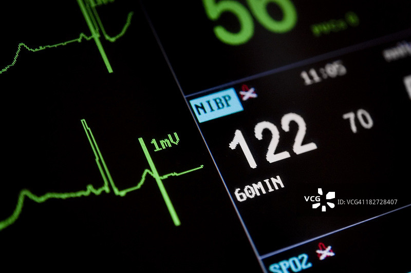 重症监护病房的心脏监测器屏幕图片素材
