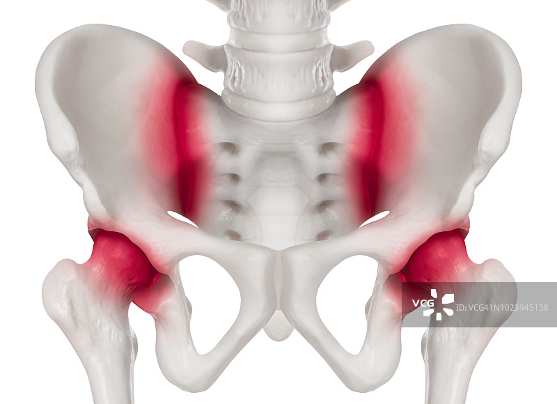 人类骨盆前视图骶髂关节和髋窝疼痛区红色高亮- 3d医学和生物医学插图-医疗保健-人体解剖学和医学概念-白色背景孤立图片素材