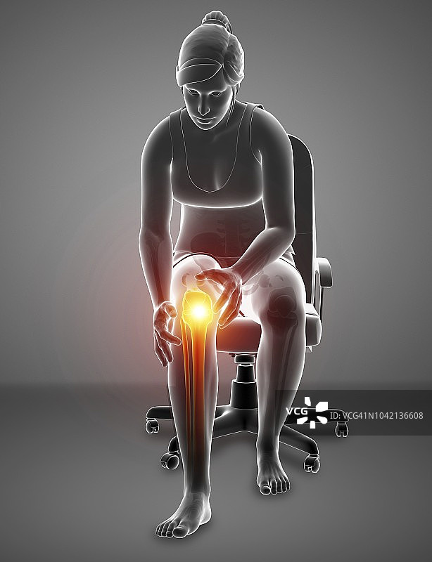 膝盖疼的女人，插图图片素材