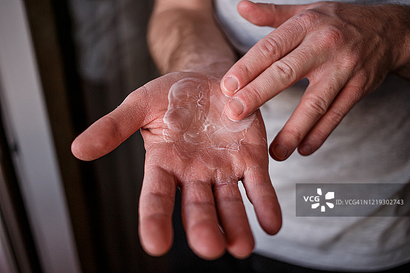 一名男子在手部涂抹润肤霜，由于在新冠肺炎疫情中使用酒精清洗，导致手部皮肤非常干燥，皮肤皲裂严重。水平闭合的内侧非常疼痛，干燥开裂的男性手图片素材