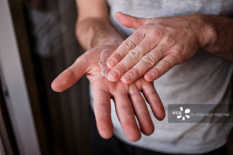 一名男子在手部涂抹润肤霜，由于在新冠肺炎疫情中使用酒精清洗，导致手部皮肤非常干燥，皮肤皲裂严重。水平闭合的内侧非常疼痛，干燥开裂的男性手图片素材