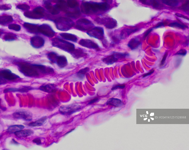 毛细管和红细胞(红细胞)ROULEAUX(堆)250X图片素材