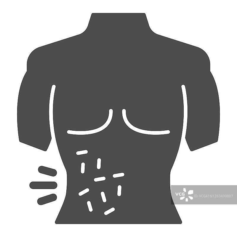身体皮疹固体图标，过敏概念，皮炎或湿疹的身体标志上的白色背景，皮肤皮疹图标在象形风格的移动概念和网页设计。矢量图形。图片素材
