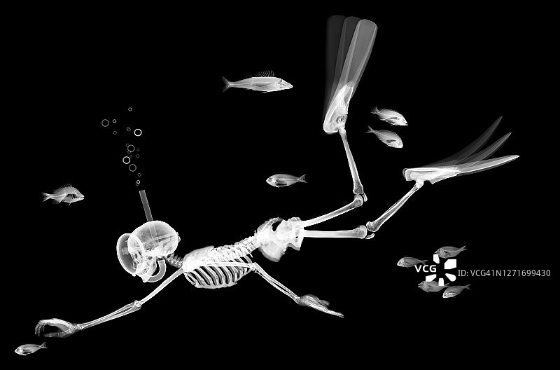 骷髅潜水在鱼中，x光图片素材