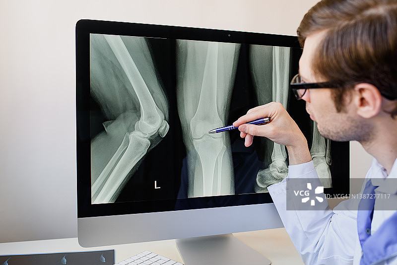 放射科医生分析病人膝盖x光片。图片素材