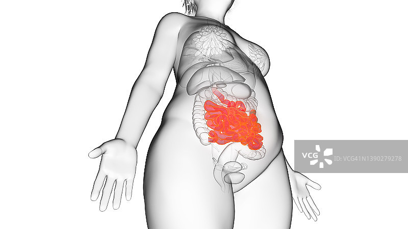肥胖妇女的小肠，插图图片素材