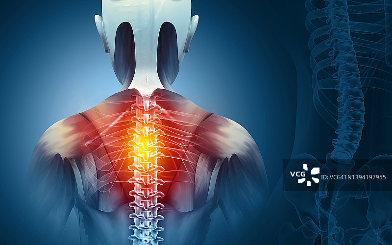 颈部疼痛，颈椎骨骼x光，医学概念。三维演示图片素材