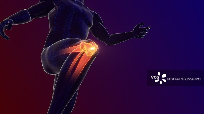 膝关节疼痛图片素材