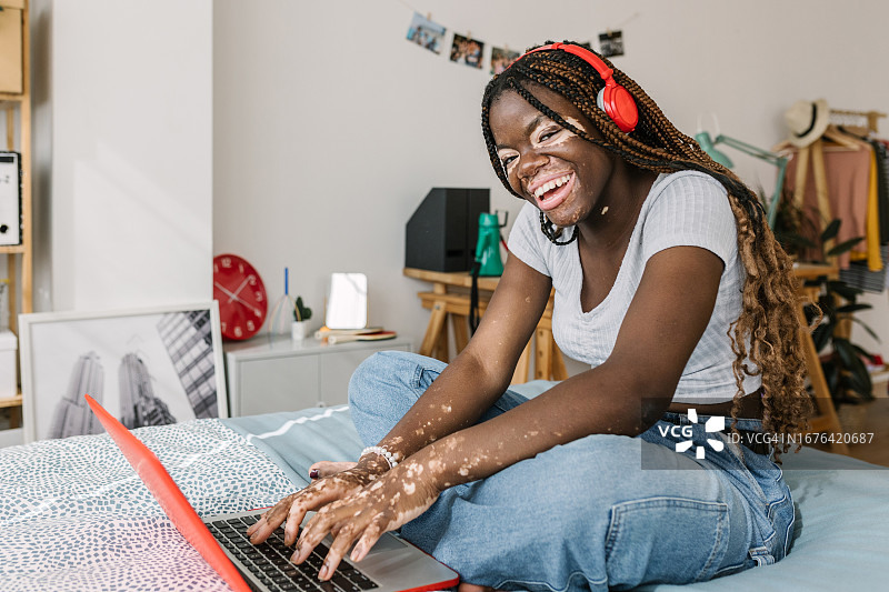 患有白癜风的年轻黑人女性坐在家里的床上使用笔记本电脑的快乐画像。电子学习和教育理念。图片素材