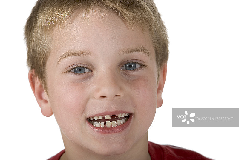 7岁男孩前牙脱落孤立，剪径图片素材
