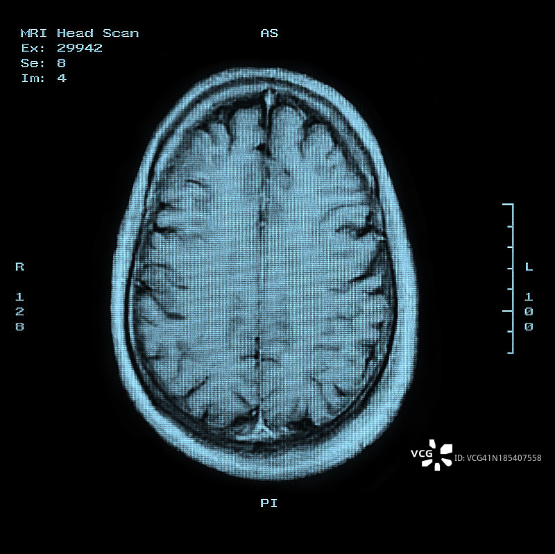 MRI头部扫描俯视图图片素材