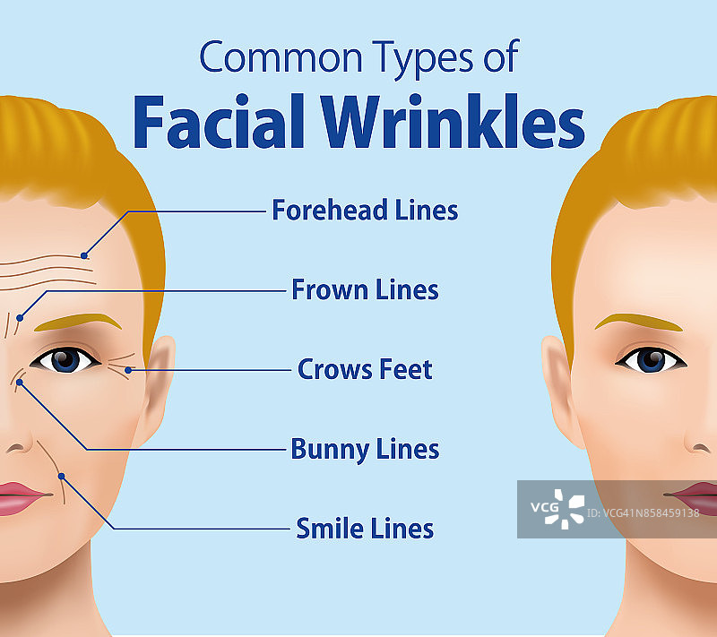 常见的面部皱纹类型。整容手术。女性面部护理理念。图片素材