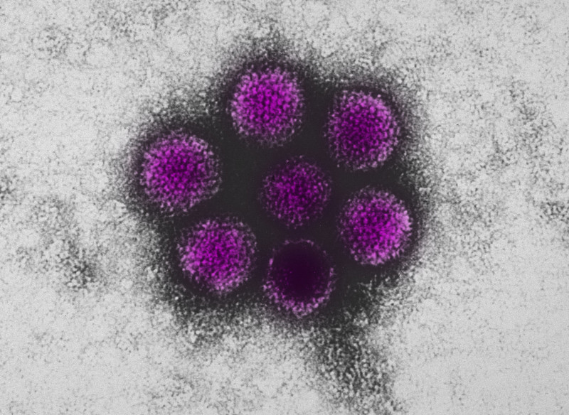 传染性犬肝炎的电子显微图图片下载