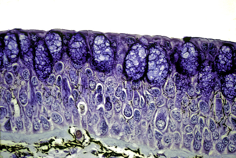 上皮细胞-肺鱼皮肤(原翼鱼属)图片下载