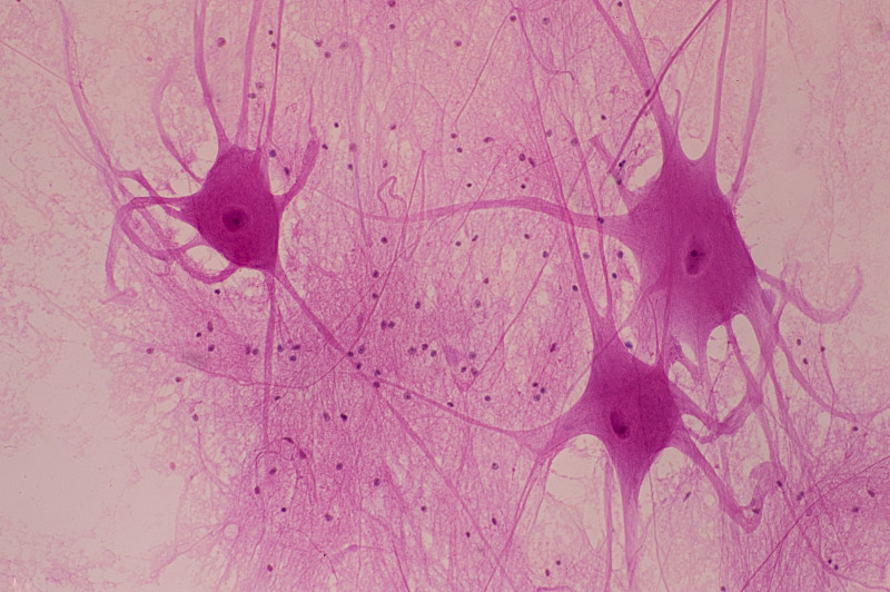 脊髓中的神经元或神经细胞-运动神经元显示细胞体(躯体，单一)和轴突，50X图片下载