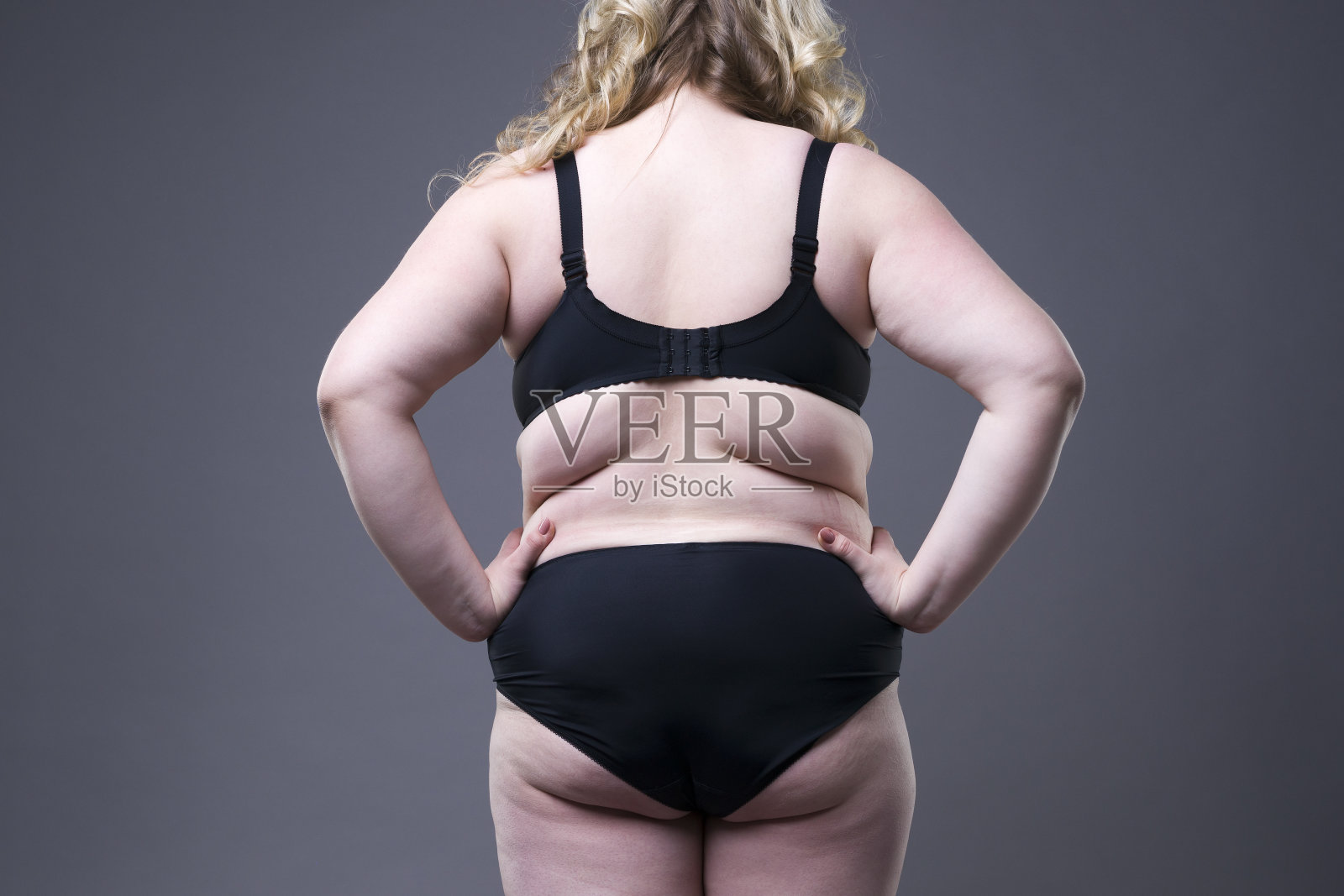 背部超重的女性，臀部有蜂窝织炎的肥胖女性照片摄影图片