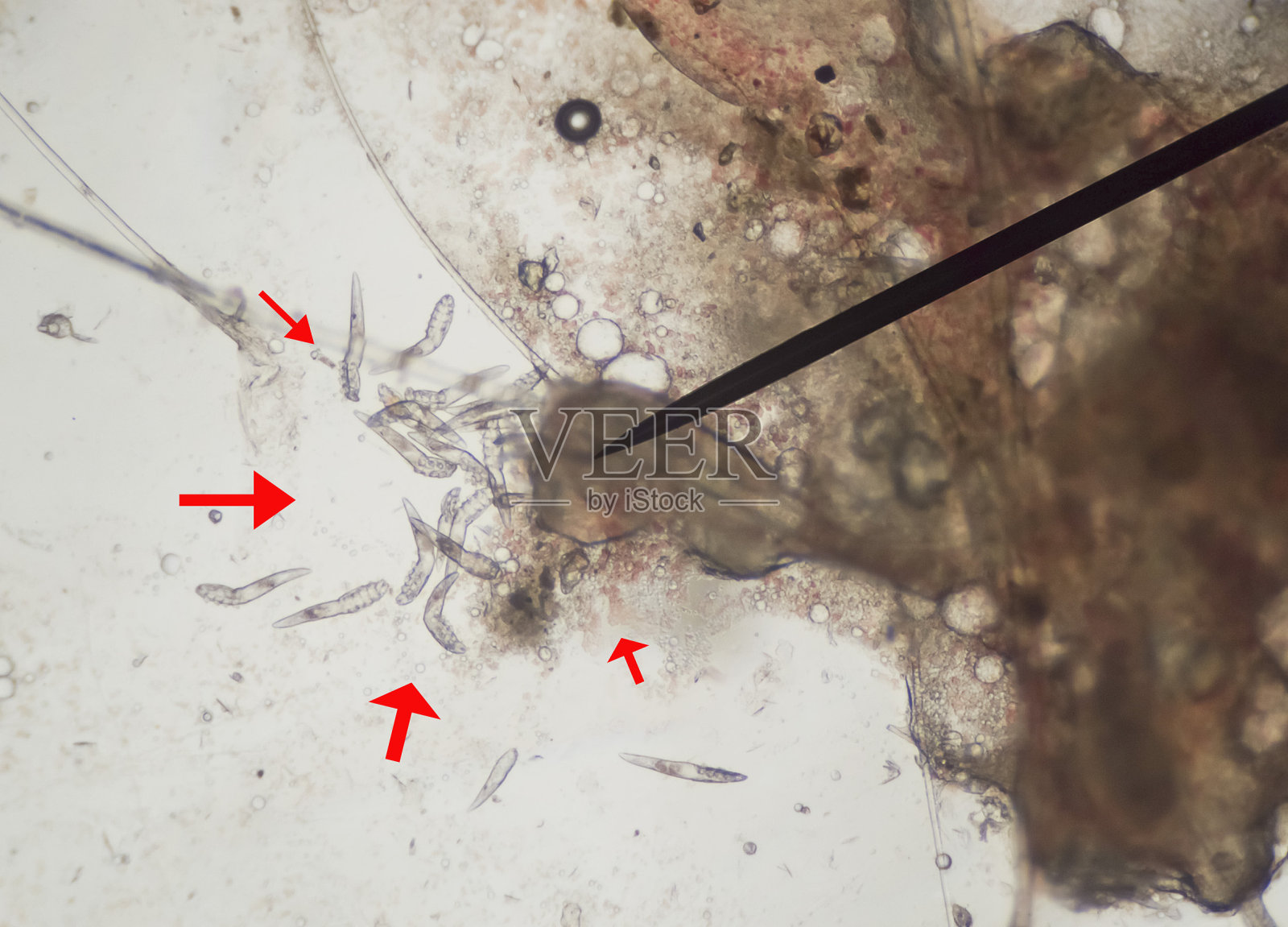 喇、蠕形螨病、寄生虫的皮肤狗拍照显微镜下照片摄影图片