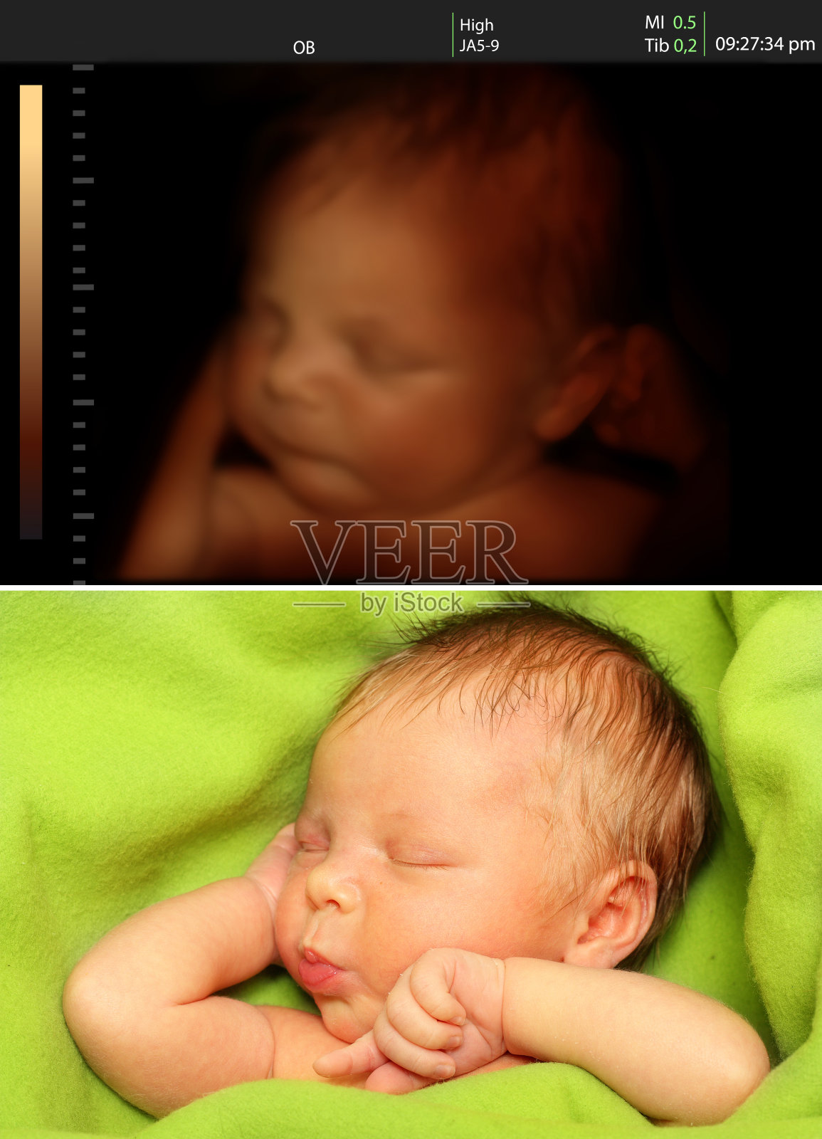 婴儿超声波和新生儿的分裂图像照片摄影图片