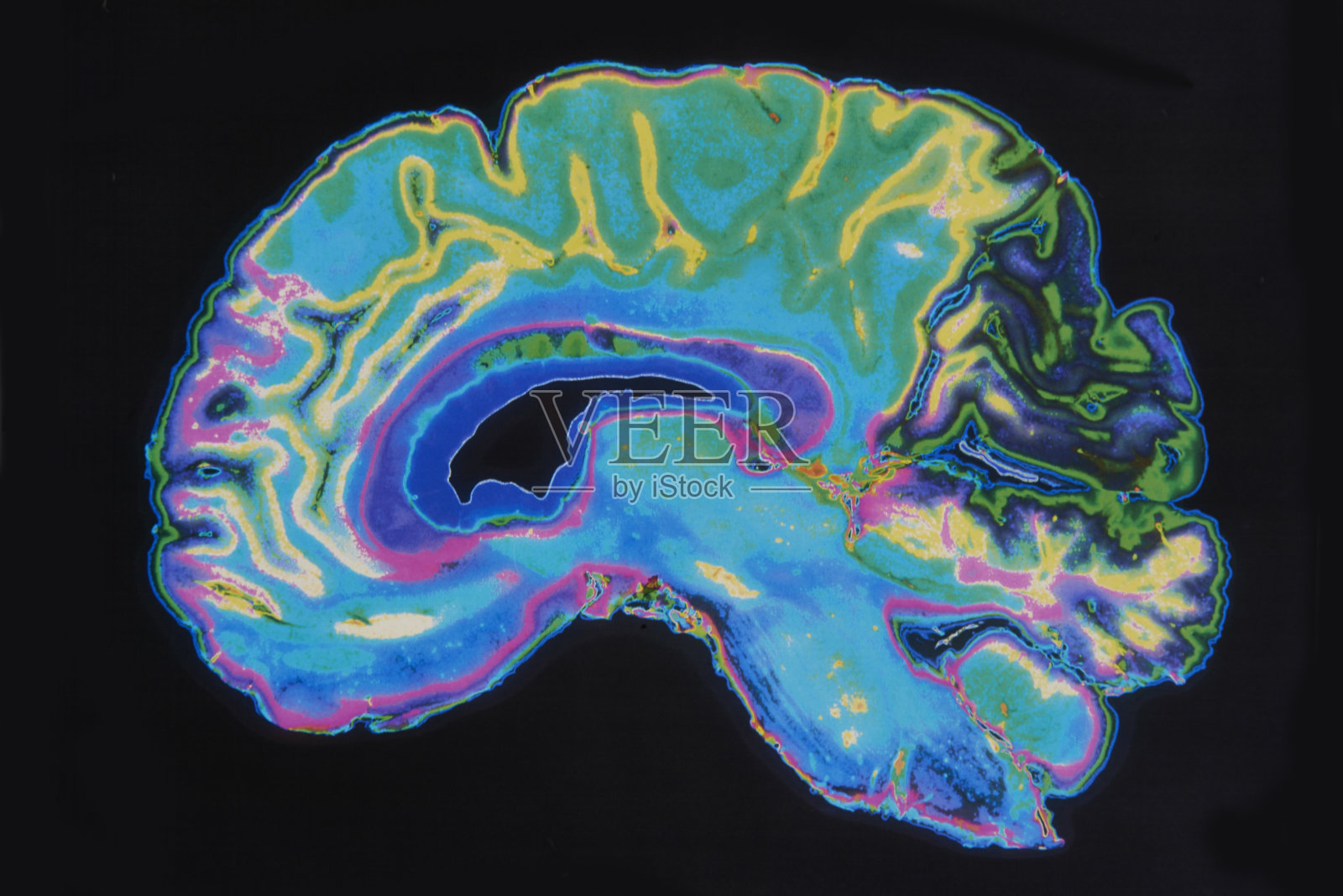 MRI图像在黑色背景上的大脑照片摄影图片