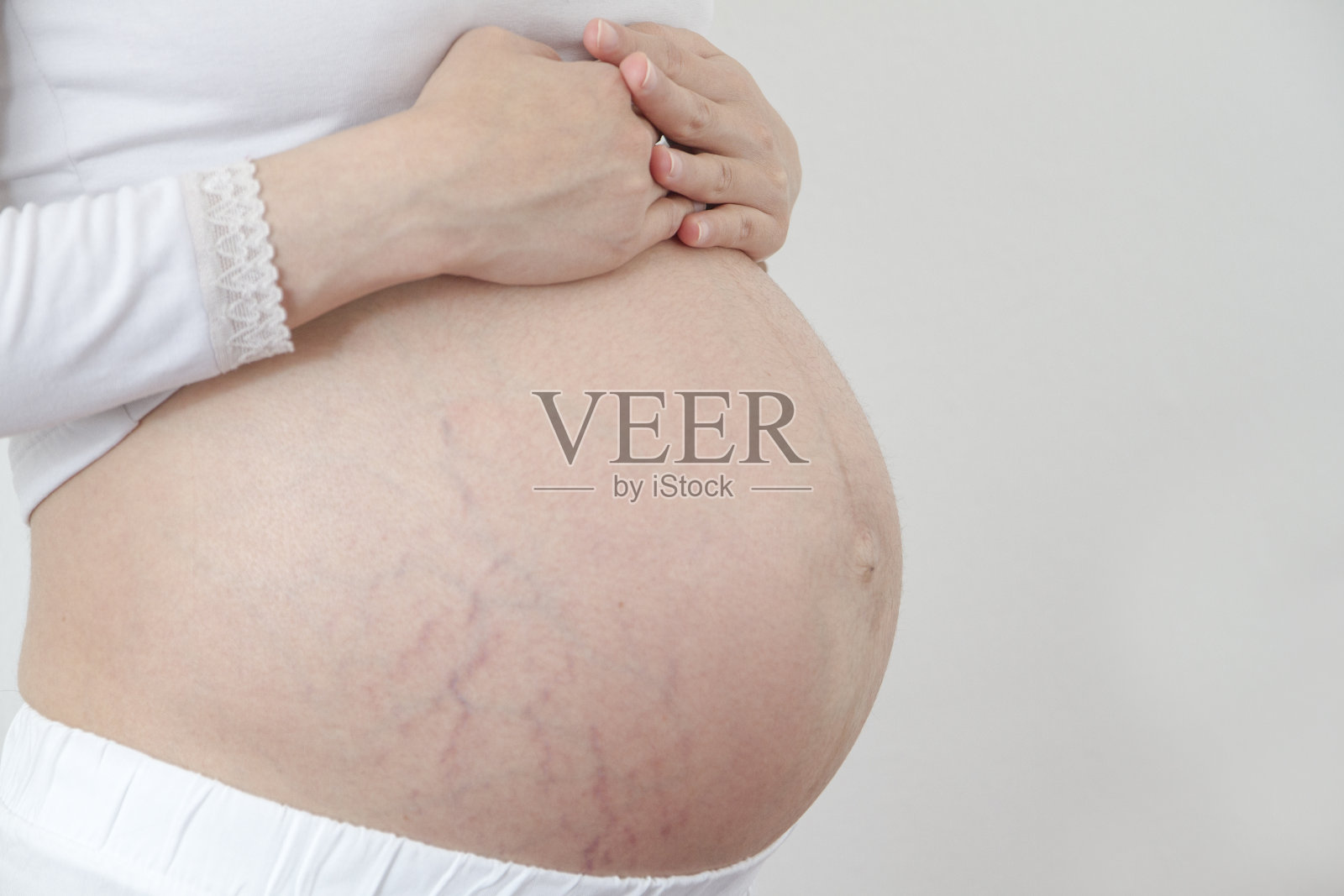 孕期妊辰纹照片摄影图片