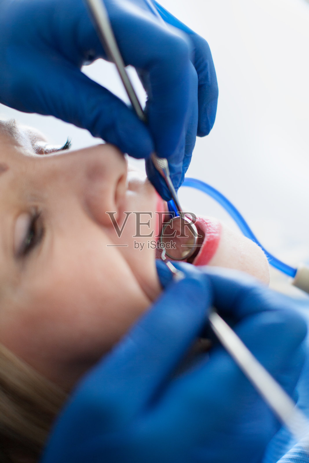 牙医为老年妇女检查和修复牙齿照片摄影图片