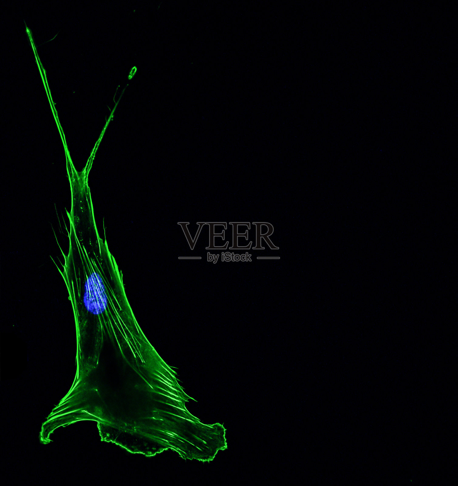 单个侵袭性肺癌细胞的免疫荧光共聚焦成像，细胞骨架为绿色，细胞核为蓝色照片摄影图片