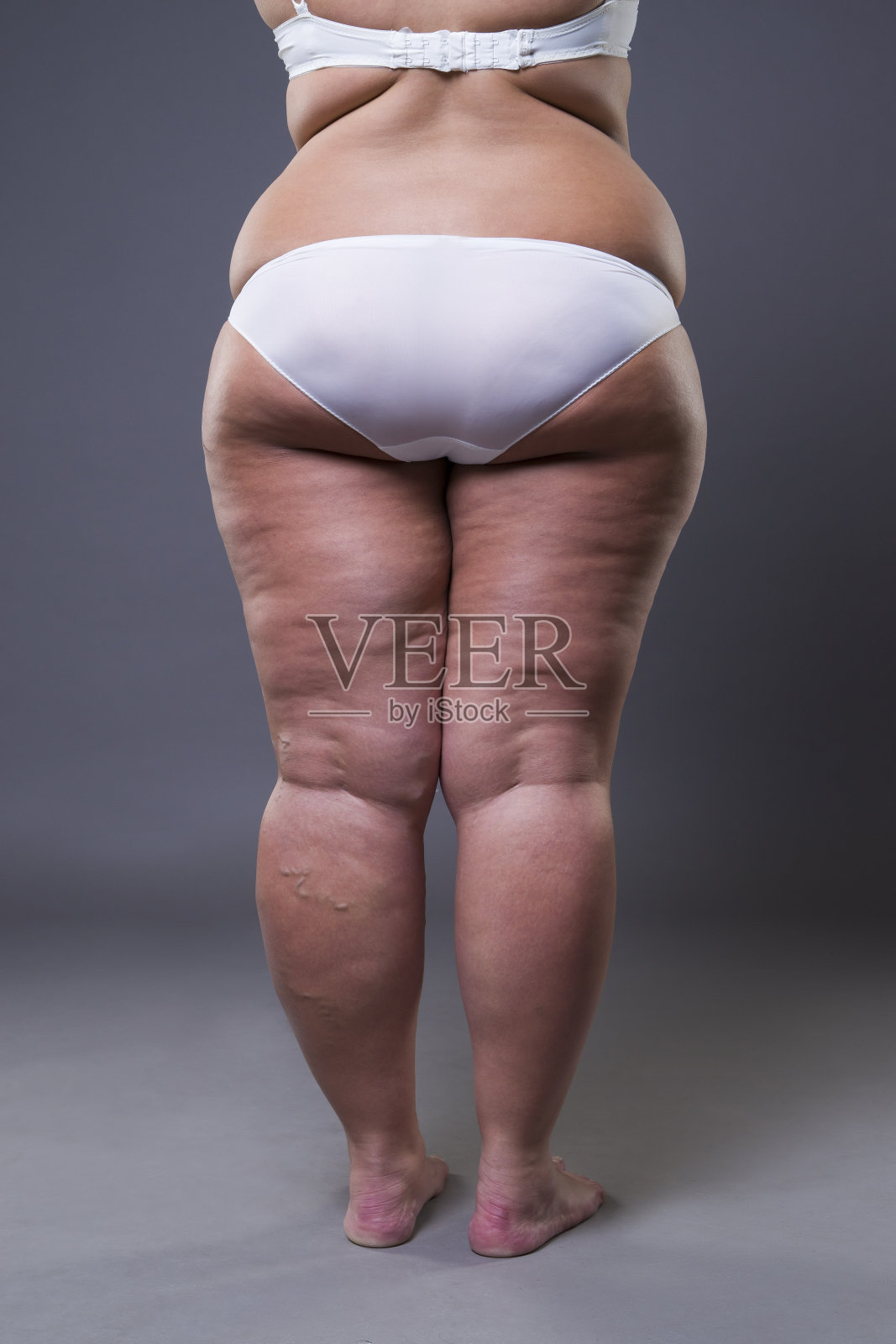 超重女性有肥胖的腿和臀部，肥胖女性的身体照片摄影图片