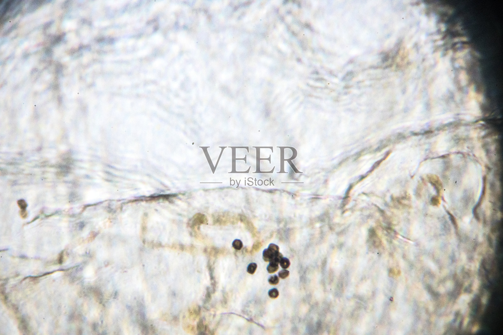 曲霉属真菌在显微镜下照片摄影图片