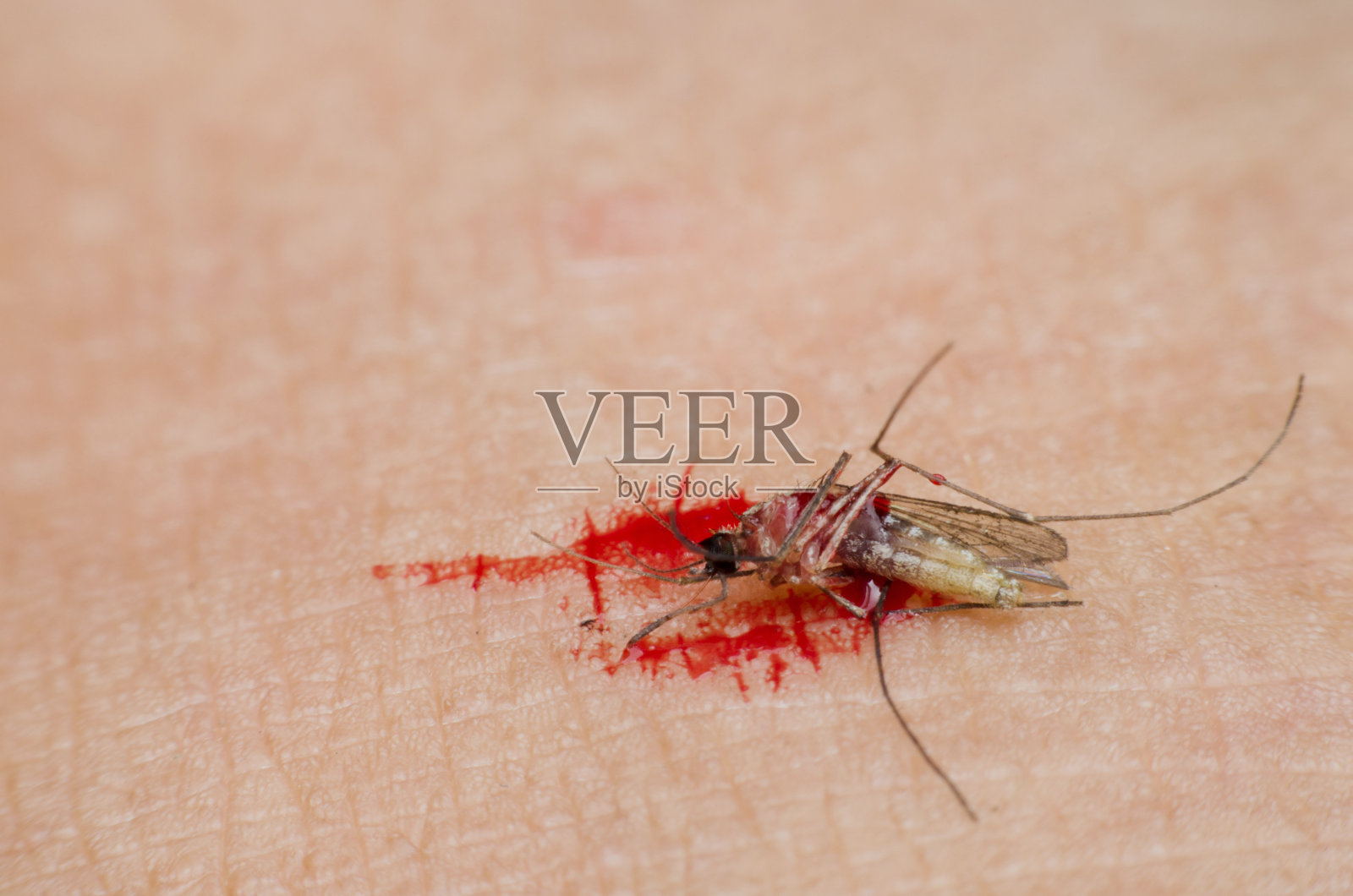 蚊子死在人的皮肤上。观念:停止病毒，停止疾病，保持健康。照片摄影图片