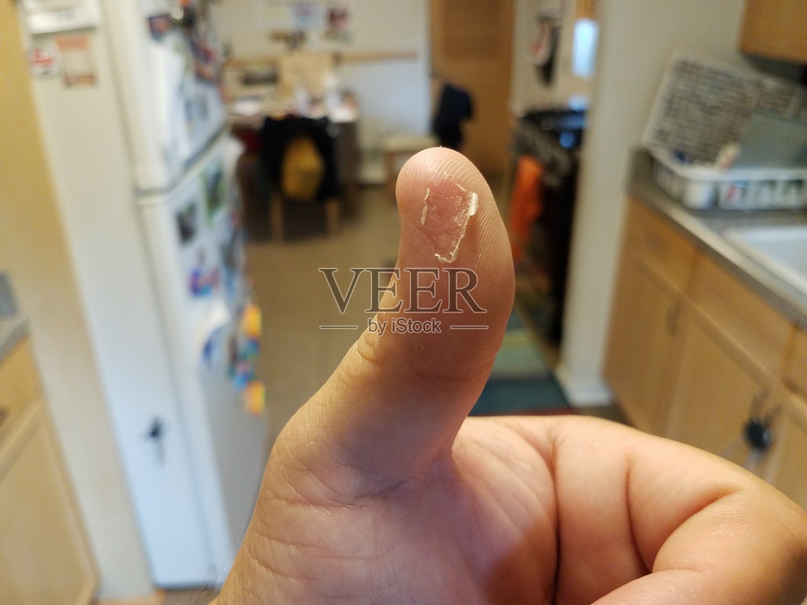 厨房里男人的拇指脱皮了照片摄影图片