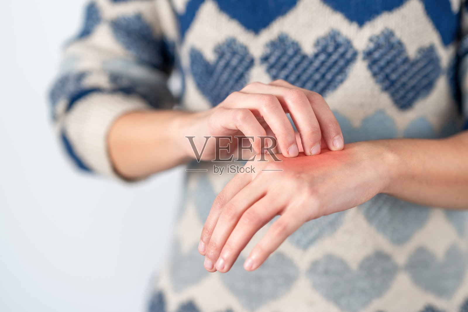 年轻女子抓挠她发痒的手。概念皮肤问题，过敏和皮肤病学。照片摄影图片
